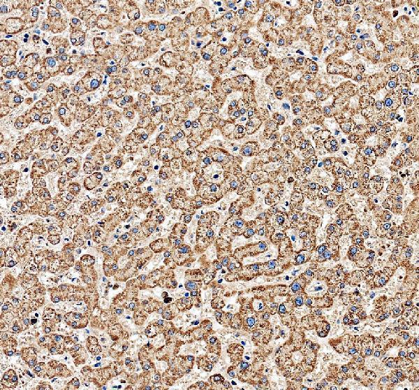 a05441 1 fdx1 primary antibodies ihc testing 2_1