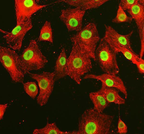 a05444 1 srrt primary antibodies if testing 16