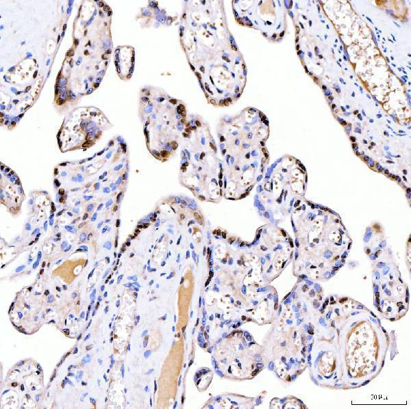 a05444 1 srrt primary antibodies ihc testing 10_1