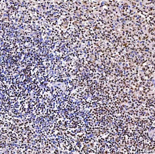 a05444 1 srrt primary antibodies ihc testing 11_1