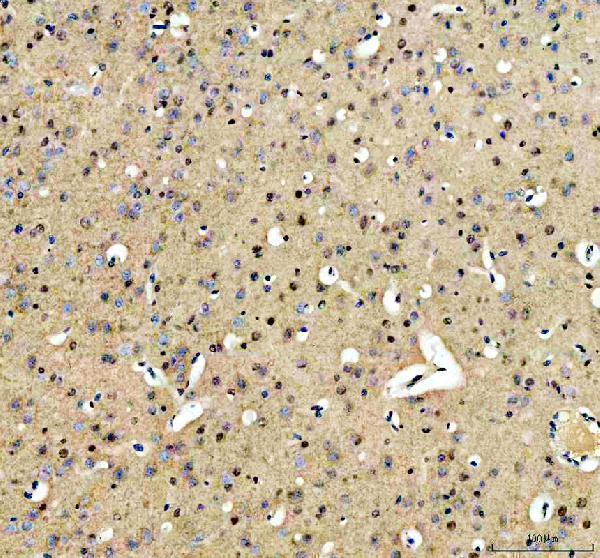 a05444 1 srrt primary antibodies ihc testing 13
