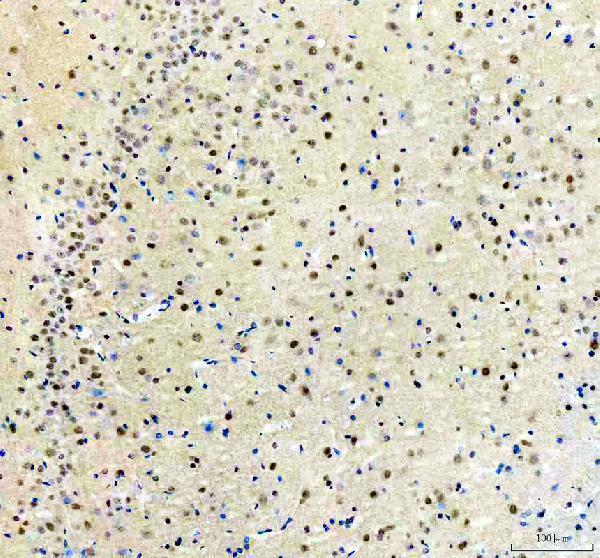 a05444 1 srrt primary antibodies ihc testing 14