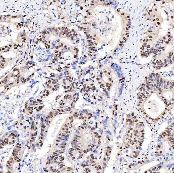  IHC analysis of ARS2/SRRT using anti-ARS2/SRRT antibody (A05444-1)
