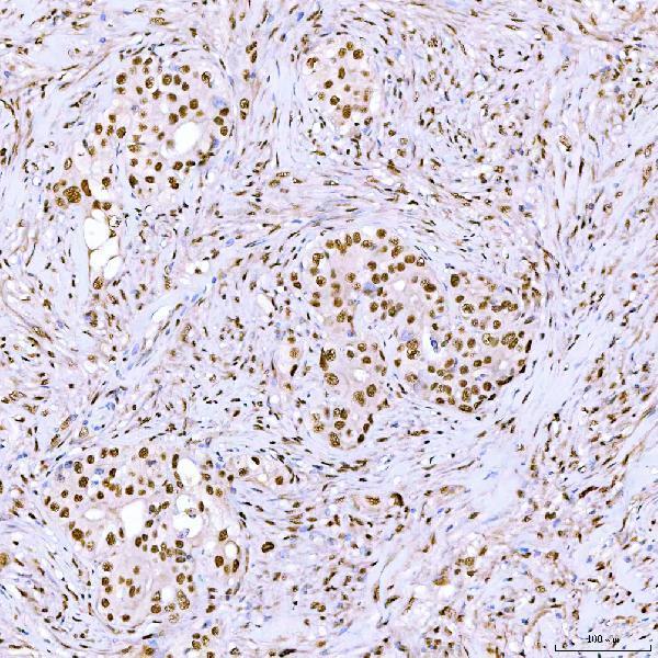  IHC analysis of ARS2/SRRT using anti-ARS2/SRRT antibody (A05444-1)