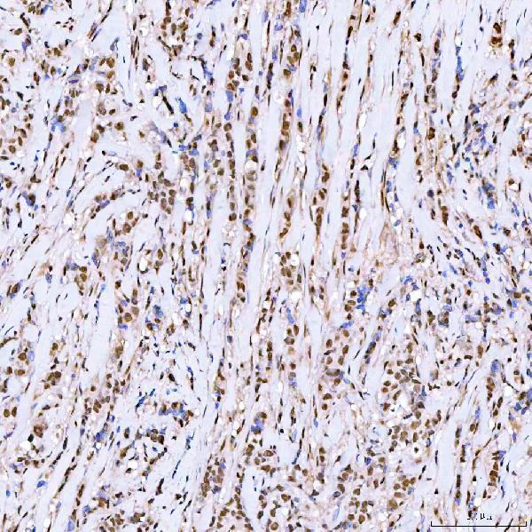 a05444 1 srrt primary antibodies ihc testing 4_1