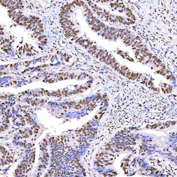 a05444 1 srrt primary antibodies ihc testing 5_1