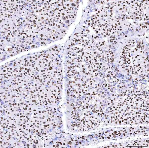 a05444 1 srrt primary antibodies ihc testing 6_1