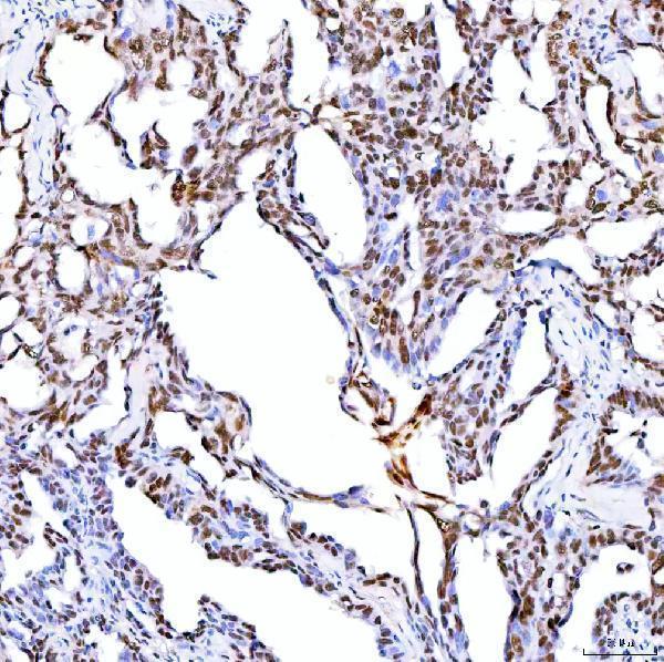a05444 1 srrt primary antibodies ihc testing 8_1