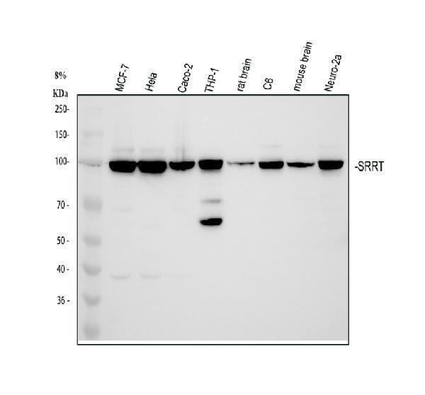  Western blot analysis of ARS2/SRRT using anti-ARS2/SRRT antibody (A05444-1)