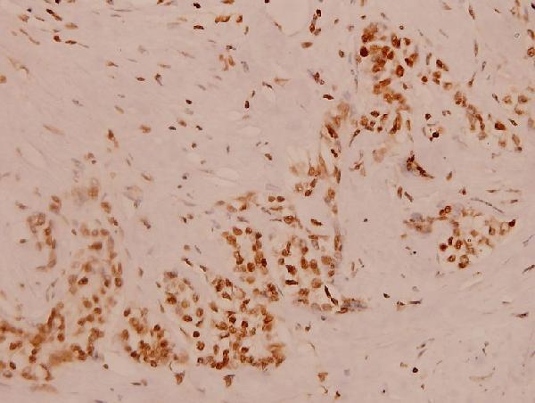 a05445 1 mcm3ap primary antiboties ihc testing 2