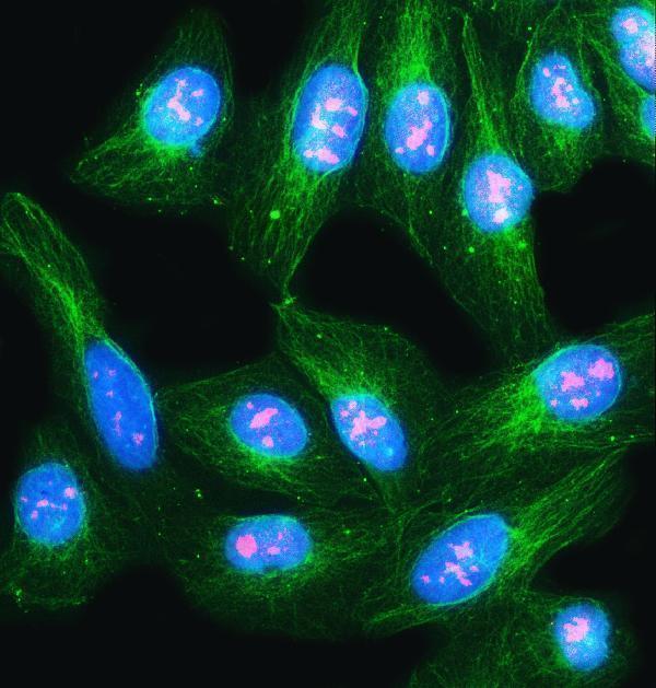 a05446 3 nvl primary antibodies if testing 10