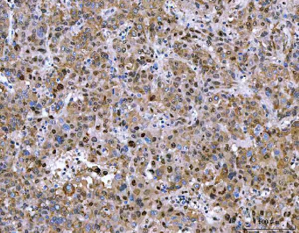  IHC analysis of NVL using anti-NVL antibody (A05446-3)