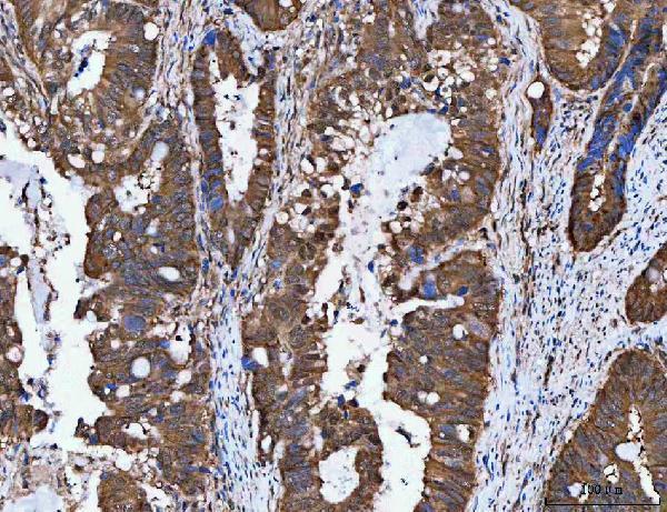  IHC analysis of NVL using anti-NVL antibody (A05446-3)