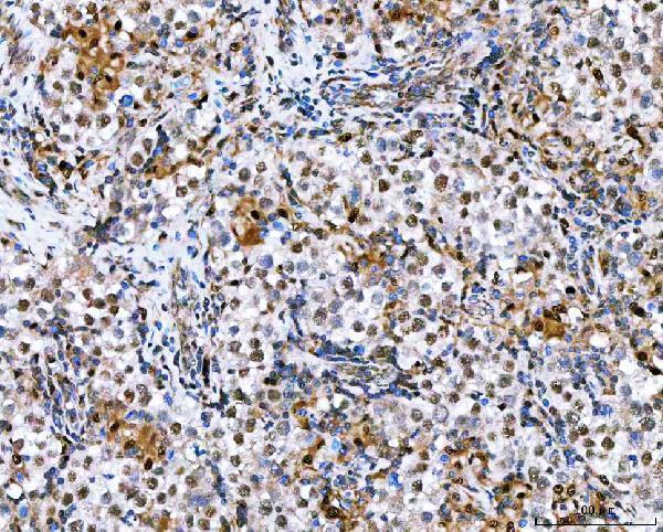 a05446 3 nvl primary antibodies ihc testing 5