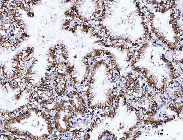a05446 3 nvl primary antibodies ihc testing 7