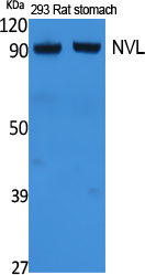 Western Blot analysis of extracts from rat stomach, 293 cells, using NVL Polyclonal Antibody