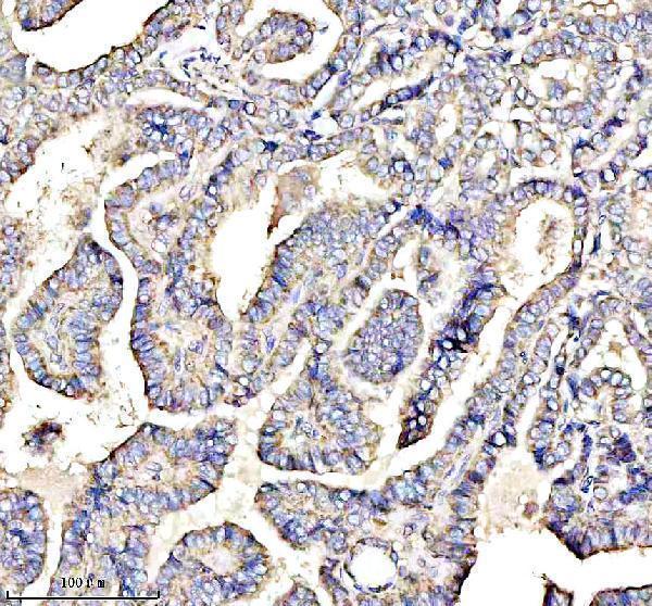  IHC analysis of ISCU using anti-ISCU antibody (A05447-1)