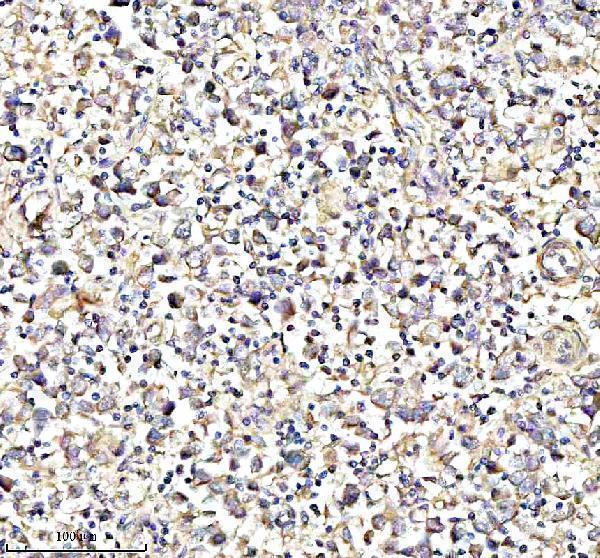 IHC analysis of ISCU using anti-ISCU antibody (A05447-1)
