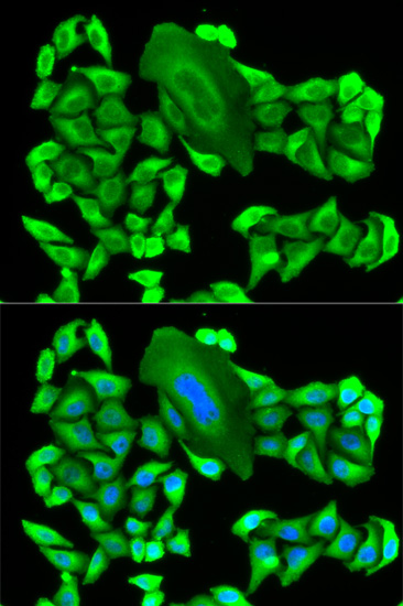 a05448 1 mtap primary antiboties ihc testing 3
