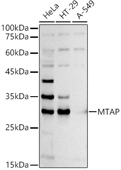 a05448 1 mtap primary antiboties wb testing 2