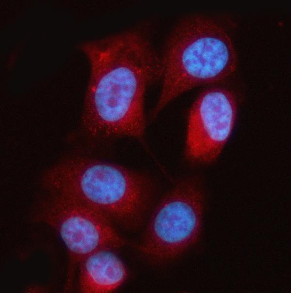  IF analysis of MTAP using anti-MTAP antibody (A05448-2)