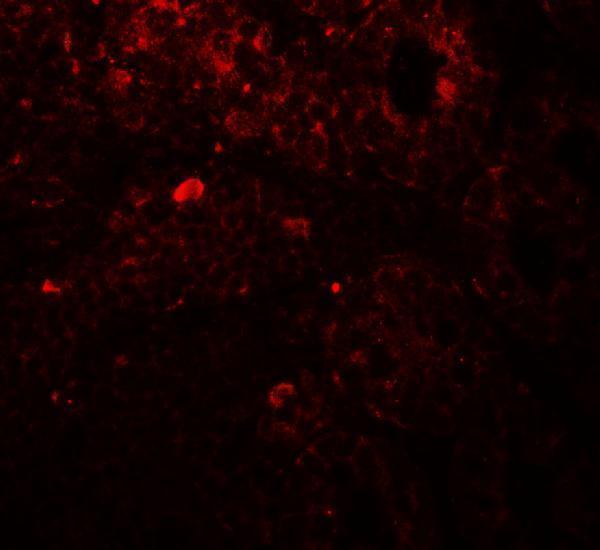 a05449 trip12 primary antibodies if testing 3