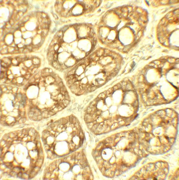 a05449 trip12 primary antibodies ihc testing 2