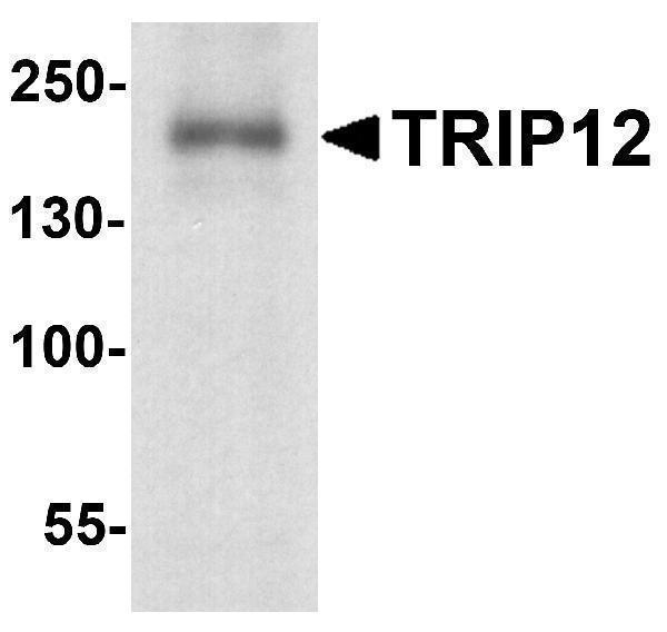 a05449 trip12 primary antibodies wb testing 1