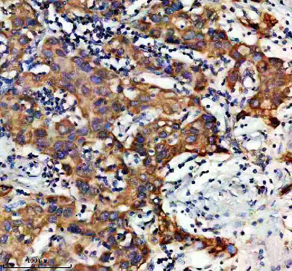 IHC analysis of EIF3I using anti-EIF3I antibody (A05450)