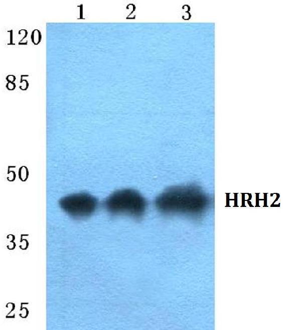 Western blot (WB) analysis of HRH2 polyclonal antibody at 1:500 dilution
Lane1:HEK293T cell lysate
Lane2:NIH-3T3 cell lysate
Lane3:H9C2 cell lysate