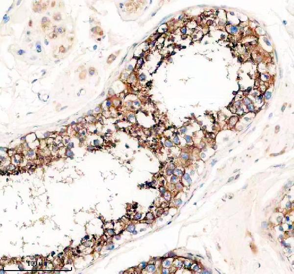 IHC analysis of PRND using anti-PRND antibody (A05457-1)