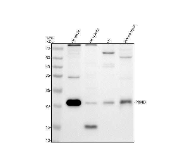 Western blot analysis of PRND using anti-PRND antibody (A05457-1)