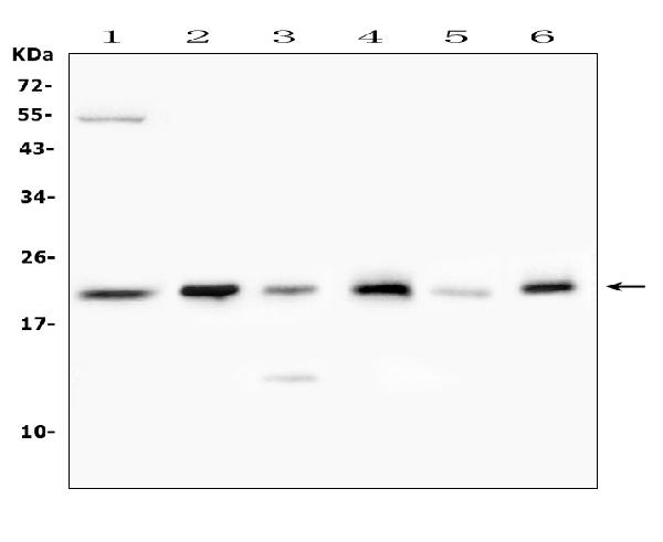 Western blot analysis of Doppel using anti-Doppel antibody (A05457). Electrophoresis was performed on a 5-20% SDS-PAGE gel at 70V (Stacking gel) / 90V (Resolving gel) for 2-3 hours. The sample well of each lane was loaded with 50ug of sample under reducing conditions. Lane 1: human SHG-44 whole cell lysate, Lane 2: rat testis tissue lysates, Lane 3: rat kidney tissue lysates, Lane 4: mouse testis tissue lysates, Lane 5: mouse kidney tissue lysates, Lane 6: mouse brain tissue lysates. After Electrophoresis, proteins were transferred to a Nitrocellulose membrane at 150mA for 50-90 minutes. Blocked the membrane with 5% Non-fat Milk/ TBS for 1.5 hour at RT. The membrane was incubated with rabbit anti-Doppel antigen affinity purified polyclonal antibody (Catalog # A05457) at 0.5 μg/mL overnight at 4°C, then washed with TBS-0.1%Tween 3 times with 5 minutes each and probed with a goat anti-rabbit IgG-HRP secondary antibody at a dilution of 1:10000 for 1.5 hour at RT. The signal is developed using an Enhanced Chemiluminescent detection (ECL) kit (Catalog # EK1002) with Tanon 5200 system. A specific band was detected for Doppel at approximately 23KD. The expected band size for Doppel is at 20KD.
