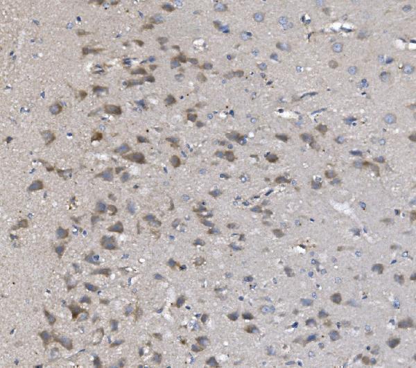  IHC analysis of PNPT1 using anti-PNPT1 antibody (A05460-1)