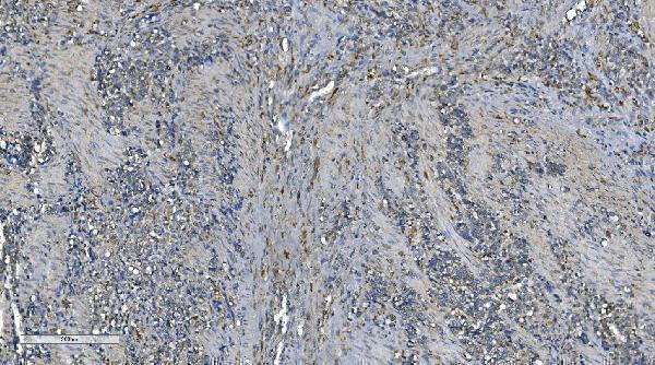  IHC analysis of PNPT1 using anti-PNPT1 antibody (A05460-1)