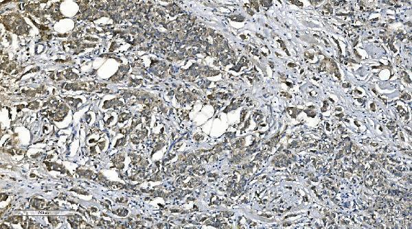 a05460 1 pnpt1 primary antibodies ihc testing 4