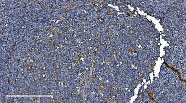 a05460 1 pnpt1 primary antibodies ihc testing 5