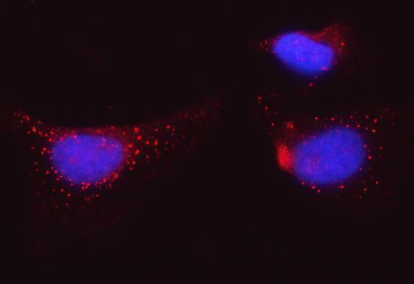 a05462 tmbim6 primary antibodies if testing 6