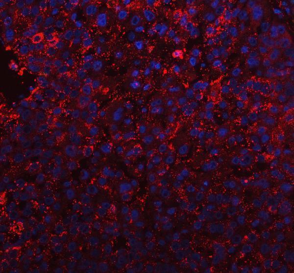 a05462 tmbim6 primary antibodies if testing 7