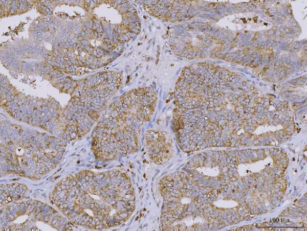  IHC analysis of BI-1/TMBIM6 using anti-BI-1/TMBIM6 antibody (A05462)