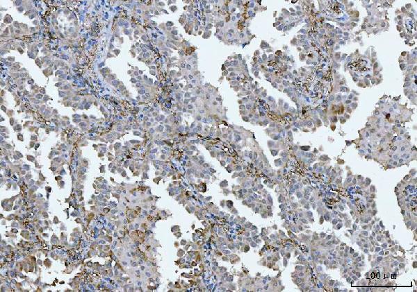 a05462 tmbim6 primary antibodies ihc testing 4