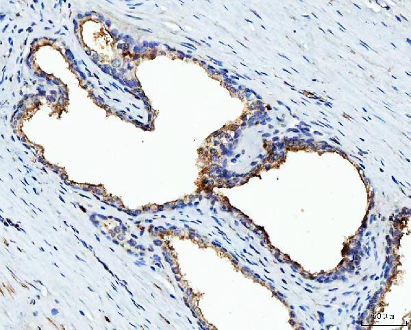 a05462 tmbim6 primary antibodies ihc testing 5