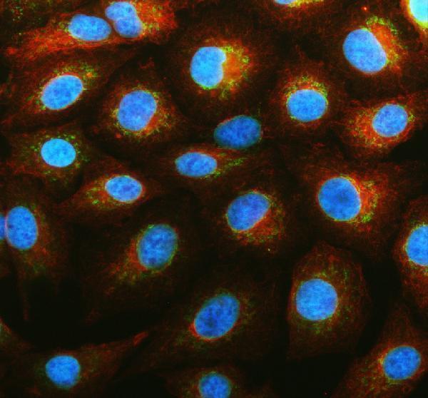 a05464 pgam5 primary antibodies if testing 1_1
