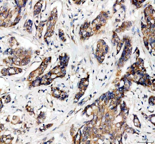 IHC analysis of PGAM5 using anti-PGAM5 antibody (A05464)