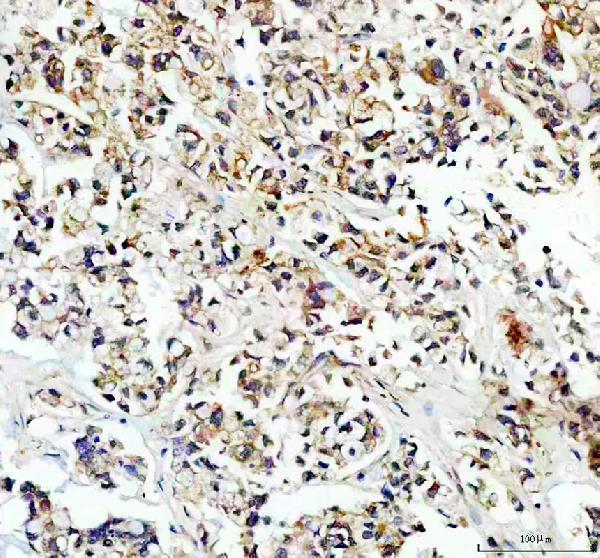 a05464 pgam5 primary antibodies ihc testing 2_1