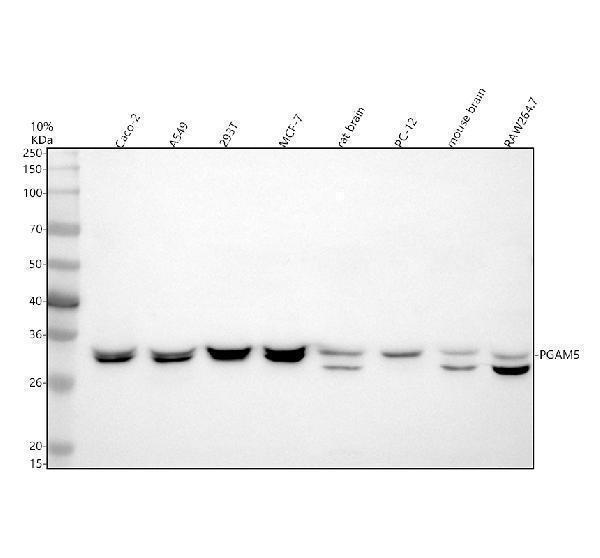 Western blot analysis of PGAM5 using anti-PGAM5 antibody (A05464)