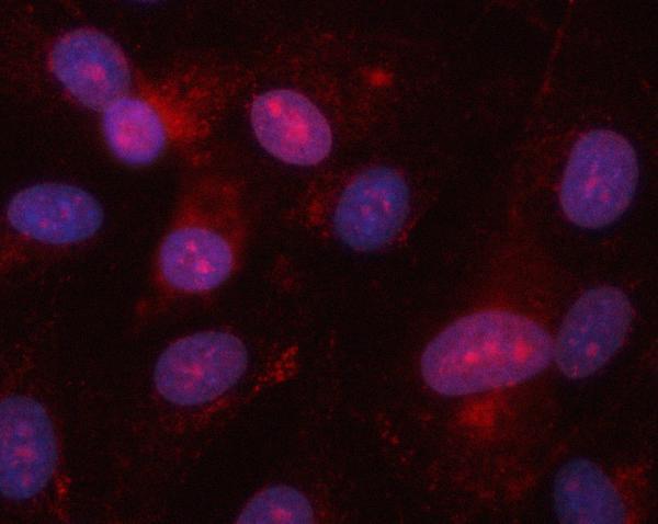 a05465 2 eif2ak1 primary antibodies if testing 5