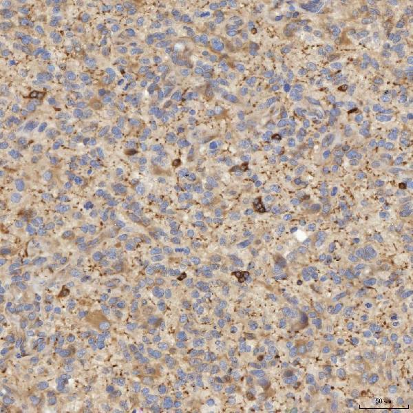  IHC analysis of EIF2AK1 using anti-EIF2AK1 antibody (A05465-2)
