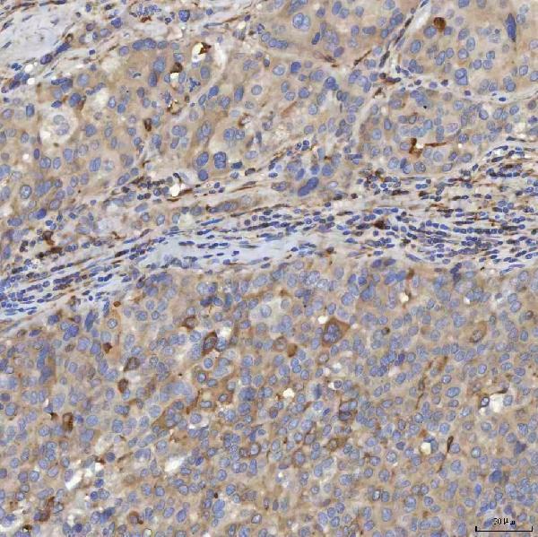  IHC analysis of EIF2AK1 using anti-EIF2AK1 antibody (A05465-2)