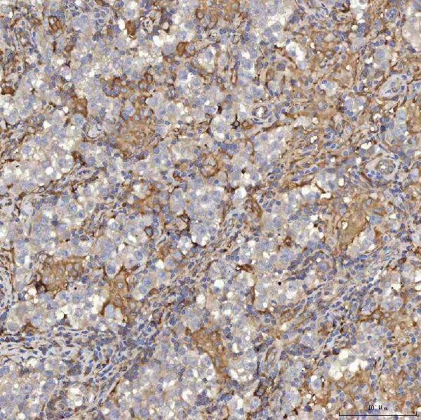a05465 2 eif2ak1 primary antibodies ihc testing 4